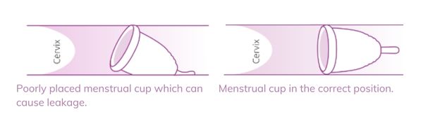 Mpower Menstrual Cup Recommendations in case of leakage